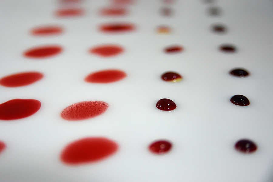 Zona de un laboratorio en el que centrifugan la sangre para poder dividir los tres elementos que la componen. En la imagen, una tabla de muestras para clasificar las bolsas de sangre donadas.